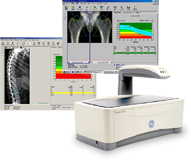 全身型骨密度測定装置