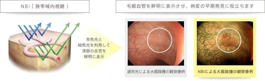 青色光と緑色光を利用して深部の血管を鮮明に表示