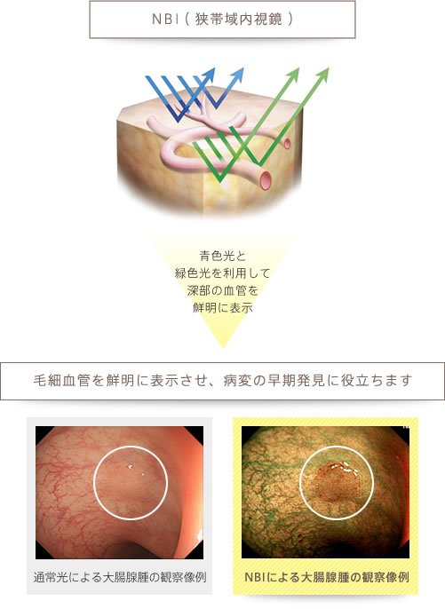 青色光と緑色光を利用して深部の血管を鮮明に表示